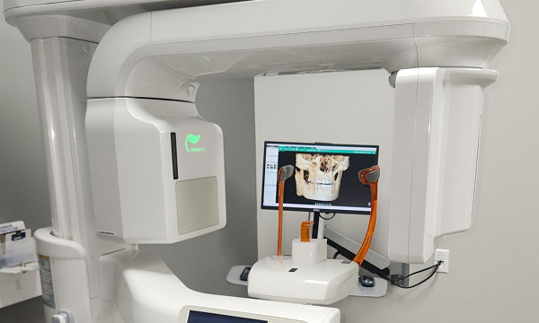 CBCT